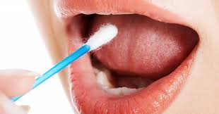 While throat cancer symptoms can vary depending on where exactly the tumor develops, pain or difficulty swallowing is known to be a common symptom across the board. World First Saliva Test Detects Hidden Throat Cancer Clinical Knowledge Network