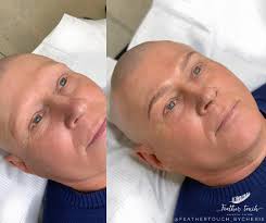 Machine strokes for the win 🏆 For my male client with alopecia 🙏🏼 My job  could not get anymore rewarding 🥰