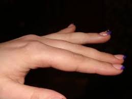 Beste grundlage für dünne, aber trotzdem stabile nagelmodellagen. Kurze Nagel Verstarkt Wieder Himmelfahrt