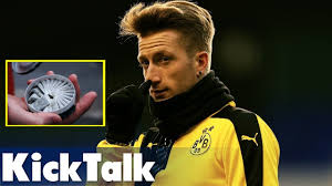 Snus ist ein feingemahlener tabak, der unter die lippen geschoben wird. Hat Marco Reus Gedopt Droge Snus Sorgt Fur Diskussionen Kicktalk Youtube