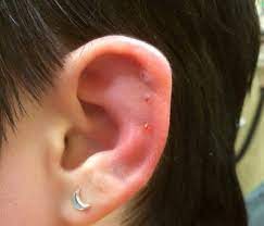 Infected Cartilage Piercings Causes Symptoms Treatment Authoritytattoo