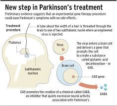 Https Www2 Ljworld Com News 2007 Jun 22 Gene Therapy Shows Promise Easing Parkinsons Disea
