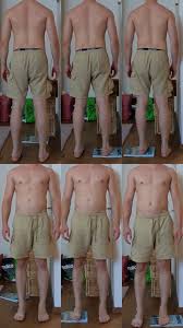 Image result for Functional Leg Length Discrepancy