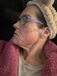 Detox mask uses other than armpits?