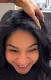 Thin hair or bald spots stealing your...