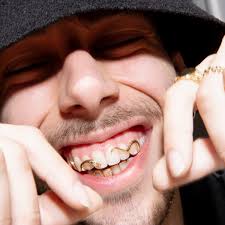 Daniël Declercq maakt grillz: 'Vaak komen mensen voor één of twee tanden,  maar het is natuurlijk leuker om out of the box te denken'