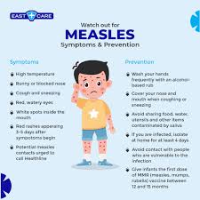 Image result for measles