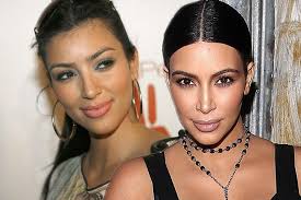 I have them too i just trimmed them a little and then i got a side fringe that goes across my forehead so theyre unoticeable :) hope this helps a xx. Kim Kardashian Admits She Had Hairline Lasered To Get Rid Of Baby Hairs That Made Her Break Out Mirror Online