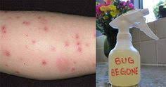 Faites Votre Lotion Anti Moustique Avec Cette Recette Natural Insect Repellant Bug Repellent Bug Spray Recipe
