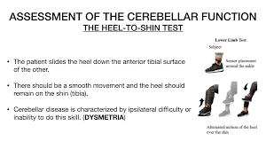 Image result for Cerebellar Function Test