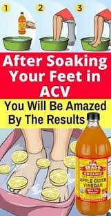 Maybe you would like to learn more about one of these? After Soaking Your Feet In Apple Cider Vinegar You Will Be Amazed By The Results Yablochnyj Sidr Yablochnyj Uksus Detoks Napitki