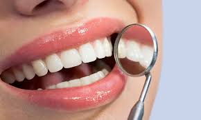 Yes, you can expect that most dental plans will but, for example, this clause might exclude the removal of asymptomatic wisdom teeth or teeth taken out. Dental Costs With And Without Insurance Member Benefits