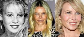In 2002, chelsea was one of the stars of oxygen's girls. Chelsea Handler Plastic Surgery Before And After Pictures 2021
