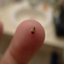 Bed bugs are insects from the genus cimex that feed on human blood, usually at night. Is This Bed Bugs Neogaf