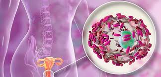 CAUSAS Y TRATAMIENTO DE LA VAGINOSIS BACTERIANA | CEyDES