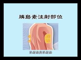 若要选择默认打印机，请选择开始按钮 ，然后选择设置。 转到设备>打印机和扫描仪> 选择打印机 >管理。 然后选择设为默认设备。 如果你选中了让 windows 管理默认打印机，则需要先取消选中，然后才能自行选择默认打印机。 在 windows 10 中，默认打印. Movie 01 èƒ°å³¶ç´ æ³¨å°„éƒ¨ä½ Youtube