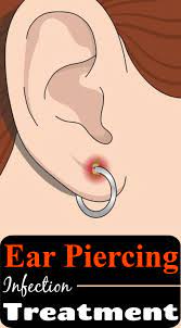 Ear Piercing Infection Treatment With Super Effective Home Remedies Skin Skincare Skincareroutine S Ear Piercings Skin Infection Remedy Ear Piercing Care