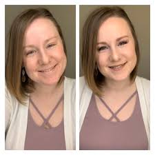 Before and after home renovation inspiration