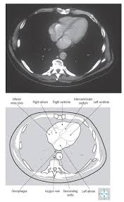 Pin On Anatomy