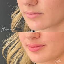 Elite Medspa + Wellness Center