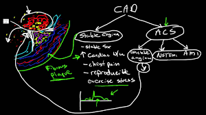 Pathophysiology Of Coronary Artery Disease