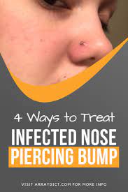 4 Things To Treat Infected Nose Piercing Bump Without Closing It Piercing Bump Nose Piercing Stud Nose Piercing Care