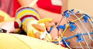 Epilepsie Bei Kindern Anfallsarten Und Prognose Netdoktor