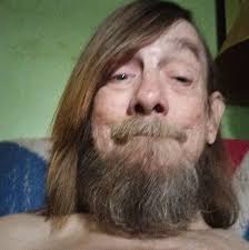 Is it safe to drive without this intake temp sensor? Mine got ripped away  after an accident and my order is coming a little later than expected