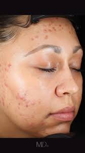 Manhattan Dermatology