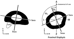 As shown in figure 2. Biomechanics Of Bone Team Bone