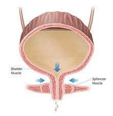 Stress Urinary Incontinence - Dr. William B Roth