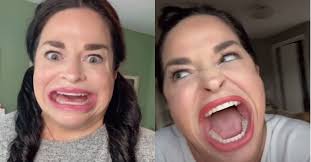 With a mouth gape of 6.52 cm i.e. Woman Becomes Known As Big Mouth Girl On Tiktok For Obvious Reason