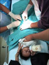 Klinik satu ini termasuk yang terbaik di batam. Soalan Lazim Prosedur Berkhatan Ketika Bayi Doktor Ini Beri Jawapan Dari A Z Untuk Ibubapa