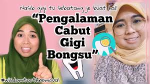 Inilah risiko mencabut gigi geraham atas jangan lupa klik subscribe untuk mendapatkan update terbaru dari. Cabut Gigi Geraham Bongsu Wisdom Tooth Removal Youtube
