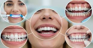 Types of Cosmetic Dental Treatments | Best Procedures Explained