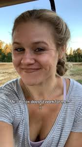 Skincare got serious…. So did the results 💥✨ , #instagood #fyp  #skincareroutine #skincare #transformation #instadaily