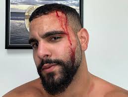 💥🗣️ Leo Terrell: “We're Going to Bankrupt These Universities” in Fight  Against Antisemitism Leo Terrell, recently appointed by Trump as head of  the federal task force to combat antisemitism, issued a fiery