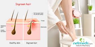 White eyebrow tweezers icon isolated on black background. Bid Adieu To Ingrown Hairs Diy Body Exfoliators For Smooth Glowing Skin