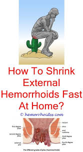 Pin On Apple Cider Vinegar For Hemorrhoids