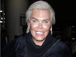 While you may not notice it initially, it can eventually impact your vision. 11 People Who Have Taken Plastic Surgery To The Extreme