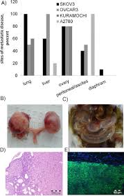 When this occurs, they may share similar signs and symptoms, for example: Intravenous Injection Of Multiple Ovarian Cancer Cell Lines Result In Download Scientific Diagram