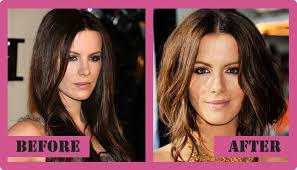 Kate beckinsale has had it with plastic surgery speculation. Kate Beckinsale Plastic Surgery Was Excellent