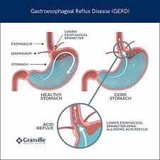 Image result for esophagus