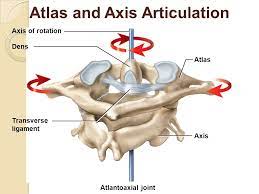 This is an online quiz called atlas vs. Atlas Joint Instability Causes Consequences And Solutions Msk Neurology