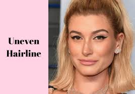 By making your widow's peak the focal point of your hairstyle, you'll stand out with a unique look. 9 Different Types Of Hairlines Low Uneven High Receding And More