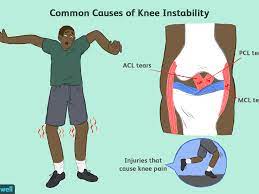 The tendon graft is passed through bone tunnels and fixed to the thighbone and lower leg bone (fibula) using screws or posts or with stitches tied around a post. Why You Feel Your Knee Giving Out