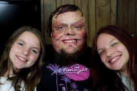 Fundraiser by Christopher Ulmer : Help for a Burn Surviving Single Dad