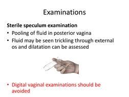 Image result for Vaginal Pooling