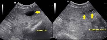 The american cancer society provides detailed information on prostate cancer and its treatment. Prostatic Diseases In Small Animals Reproductive System Veterinary Manual