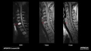 Mri scan stems from magnetic resonance imaging. Aperto Lucent 0 4t Hitachi Medical Systems